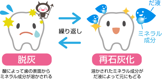 むし歯になる原因