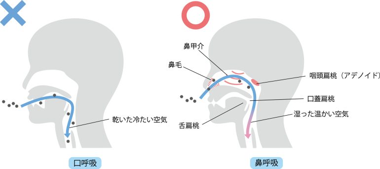 口呼吸と悪い歯並びの関係