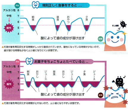 むし歯になる原因