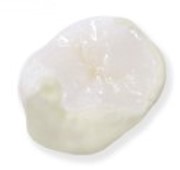 ジルコニア(ナチュレαP)