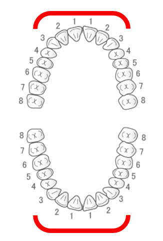 スマイルトゥルーで治療出来る症状