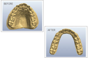 術前と術後の予想データ