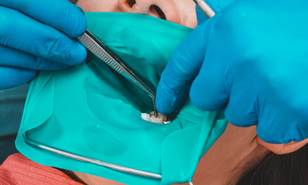 ラバーダム防湿