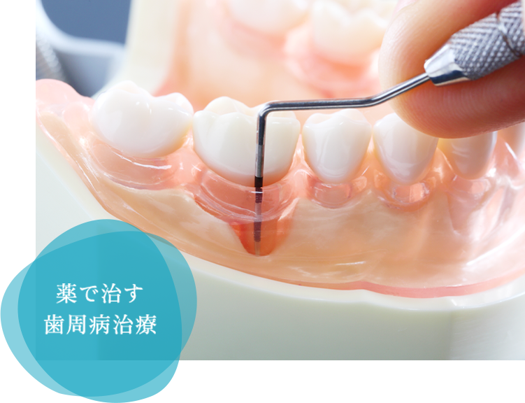 薬で治す歯周病治療